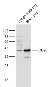 CD20 Rabbit Polyclonal Antibody