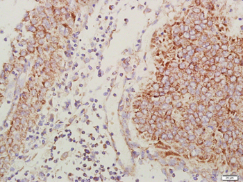 CXCR4 Rabbit Polyclonal Antibody