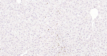 CD68 Rabbit Polyclonal Antibody