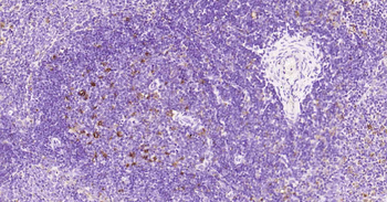 CD68 Rabbit Polyclonal Antibody
