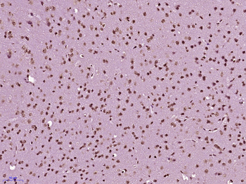 Phospho-DNA PKcs (Thr2638) Rabbit Polyclonal Antibody