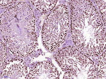 Phospho-DNA PKcs (Thr2638) Rabbit Polyclonal Antibody