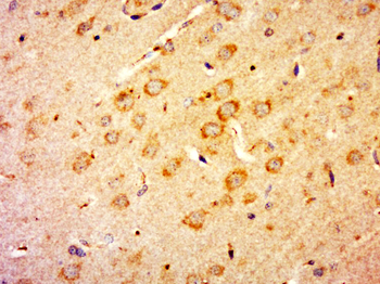 EAAT2 Rabbit Polyclonal Antibody