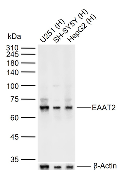 EAAT2 Rabbit Polyclonal Antibody