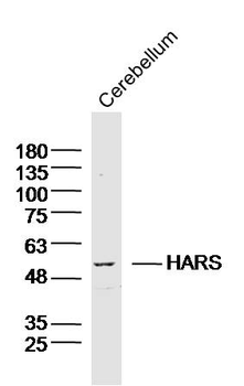 HARS Rabbit Polyclonal Antibody