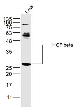 HGF beta Rabbit Polyclonal Antibody