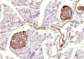 Phospho-IRS1 (Tyr632) Rabbit Polyclonal Antibody