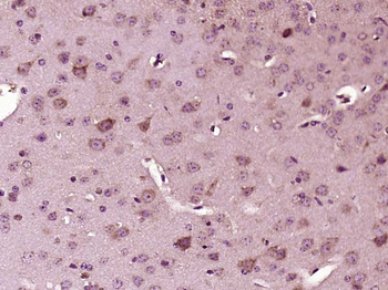 Phospho-IRS1 (Tyr1179) Rabbit Polyclonal Antibody