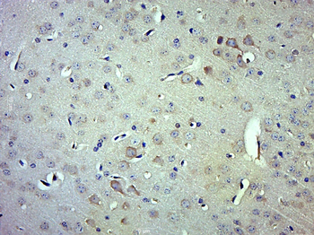 ITCH/AIP4 Rabbit Polyclonal Antibody