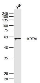 KRT81 Rabbit Polyclonal Antibody