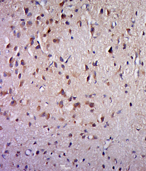 Phospho-Kv4.2 (Thr607) Rabbit Polyclonal Antibody