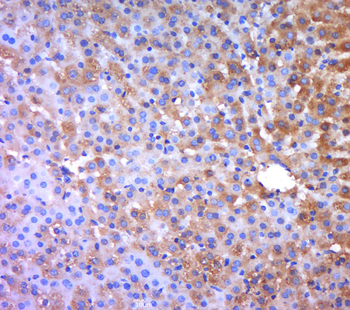 LRCH1 Rabbit Polyclonal Antibody