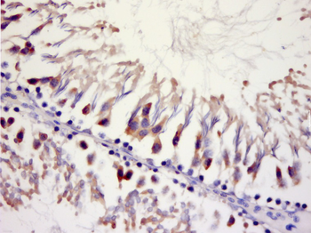 MCU Rabbit Polyclonal Antibody