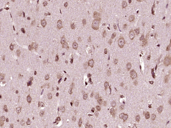 NEDD4 Rabbit Polyclonal Antibody