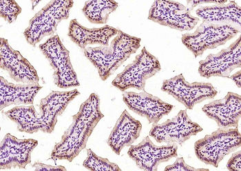 PTRHD1 Rabbit Polyclonal Antibody