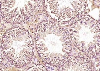 PTRHD1 Rabbit Polyclonal Antibody