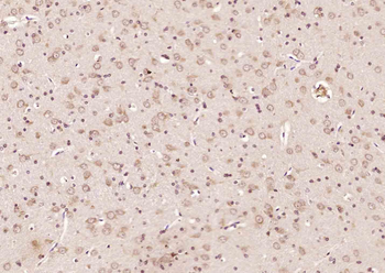 PTRHD1 Rabbit Polyclonal Antibody