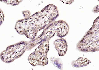 PURB Rabbit Polyclonal Antibody