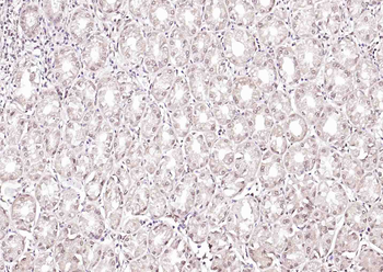 PURB Rabbit Polyclonal Antibody
