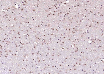 PURB Rabbit Polyclonal Antibody