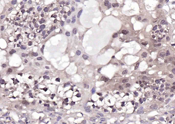 PURB Rabbit Polyclonal Antibody