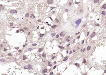 PURB Rabbit Polyclonal Antibody