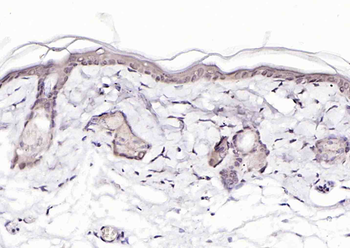 PURB Rabbit Polyclonal Antibody