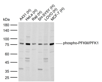 Phospho-PFKM/PFK1 (Ser775) Rabbit Polyclonal Antibody