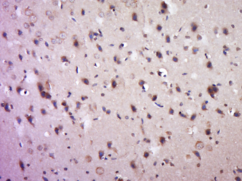 Phospho-Paxillin (Ser83) Rabbit Polyclonal Antibody