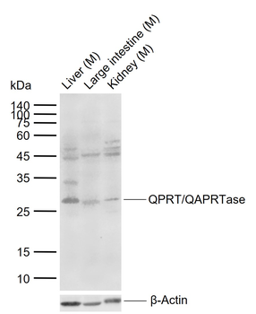 QPRT/QAPRTase Rabbit Polyclonal Antibody