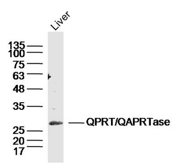 QPRT/QAPRTase Rabbit Polyclonal Antibody