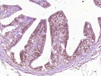 RAD21L1 Rabbit Polyclonal Antibody