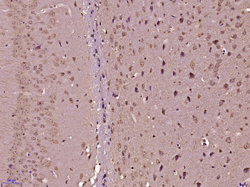 RANBP16/Exp7 Rabbit Polyclonal Antibody