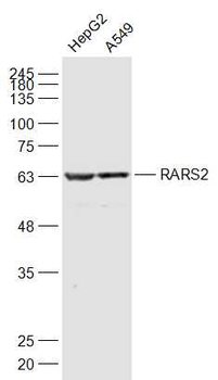 RARS2 Rabbit Polyclonal Antibody