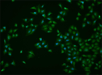 Rad51 Rabbit Polyclonal Antibody