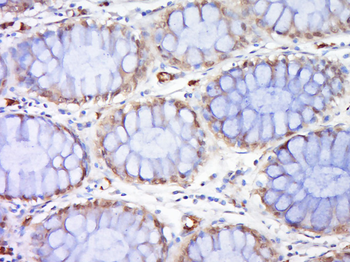 Rad51 Rabbit Polyclonal Antibody