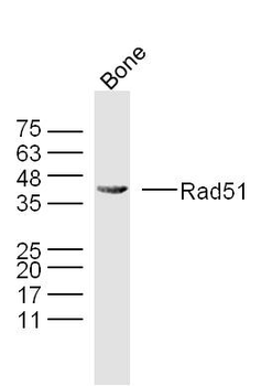 Rad51 Rabbit Polyclonal Antibody