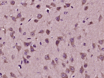 SDF2L1 Rabbit Polyclonal Antibody