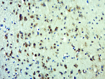 SENP7 Rabbit Polyclonal Antibody
