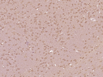 SGTB Rabbit Polyclonal Antibody