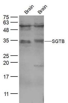 SGTB Rabbit Polyclonal Antibody