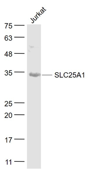 SLC25A1 Rabbit Polyclonal Antibody