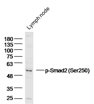 Phospho-Smad2 (Ser250) Rabbit Polyclonal Antibody