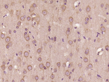 TRIM23 Rabbit Polyclonal Antibody
