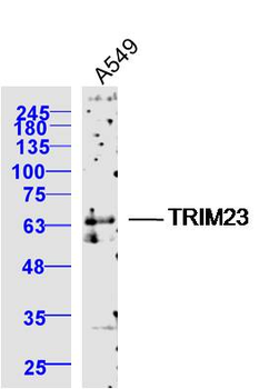 TRIM23 Rabbit Polyclonal Antibody