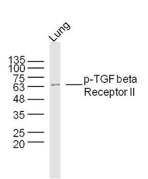 Phospho-TGF beta Receptor II (Ser225) Rabbit Polyclonal Antibody