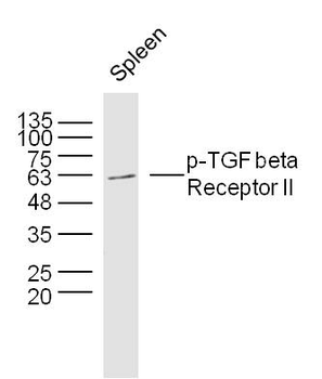 Phospho-TGF beta Receptor II (Ser225) Rabbit Polyclonal Antibody