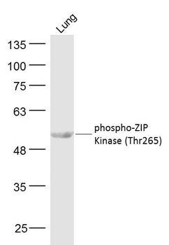 Phospho-ZIP Kinase (Thr265) Rabbit Polyclonal Antibody