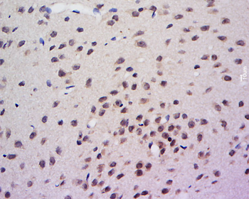 AHR Rabbit Polyclonal Antibody