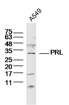 PRL Rabbit Polyclonal Antibody